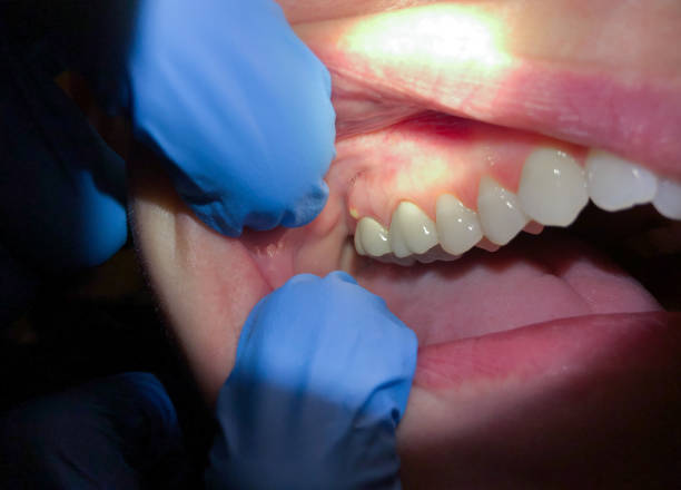  Greenbriar, FL Emergency Dentist Pros